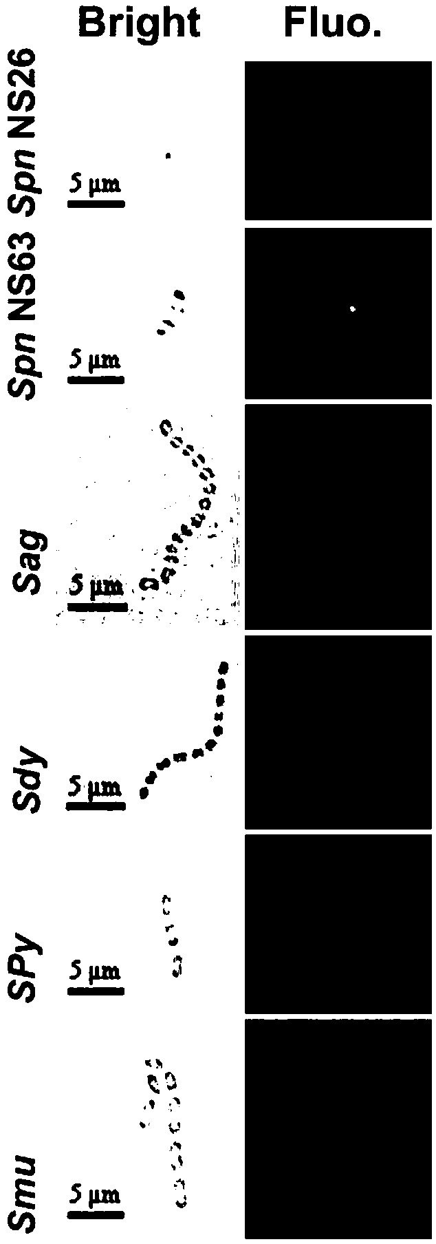 High-efficiency streptococcus pneumonia chimeric lyase and its mutant and application thereof