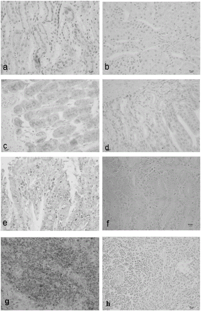 Envision immunohistochemical detection method of Clostridum Perfringens alpha toxin