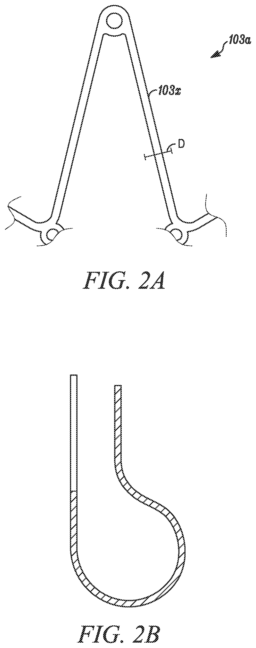 Intra-atrial implants made of non-braided material