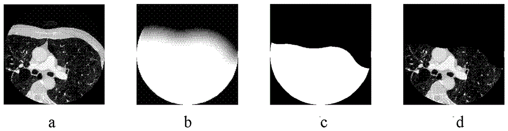 Whole Heart Extraction Method Based on Cardiac CT Image