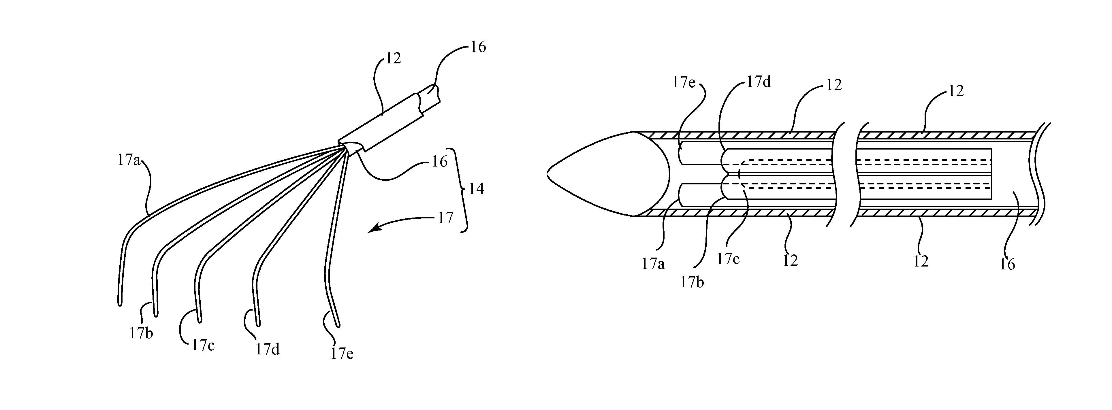 Minimally invasive rake retractor and method for using same