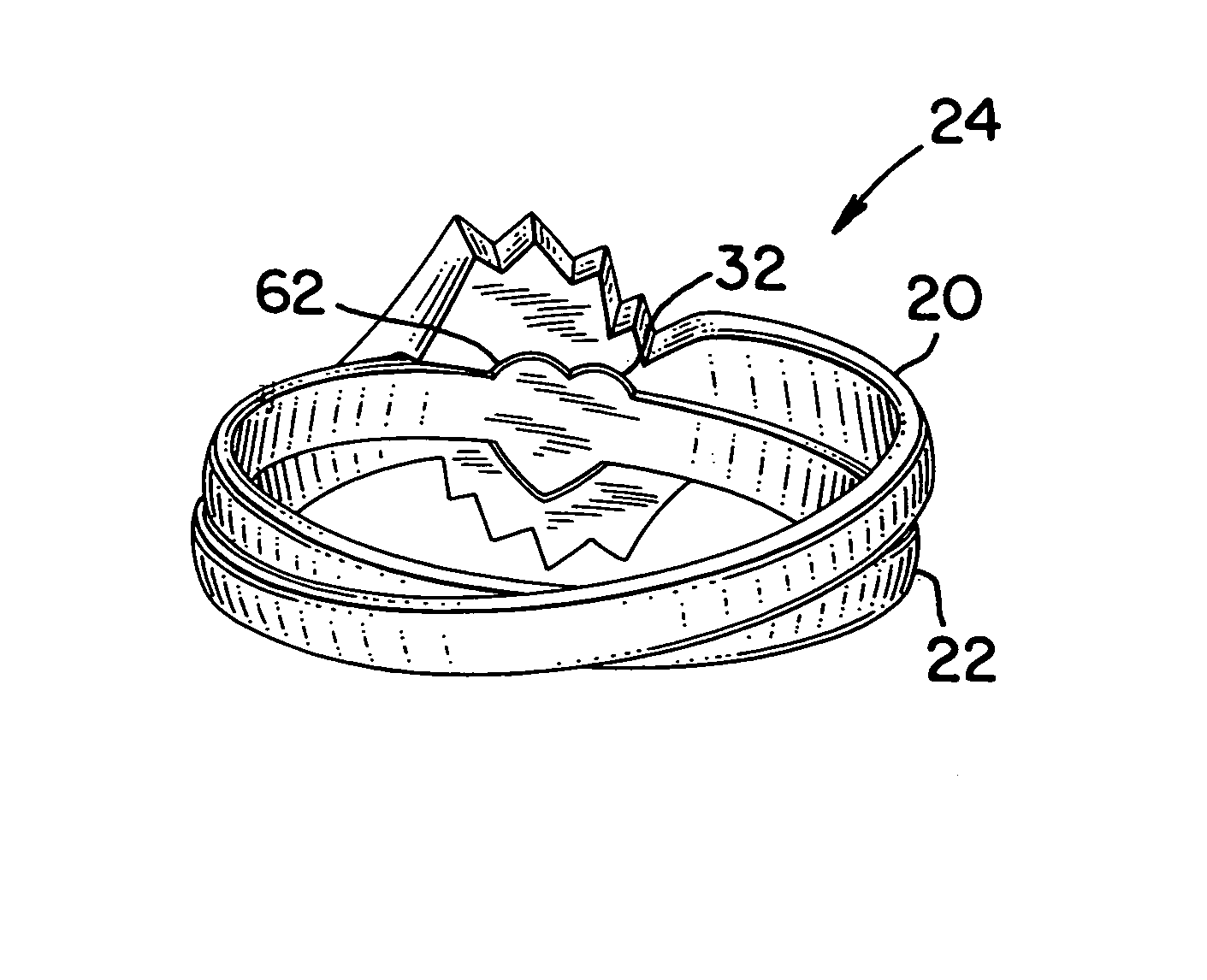 Engagement set with locking arrangement and rear crossover configuration