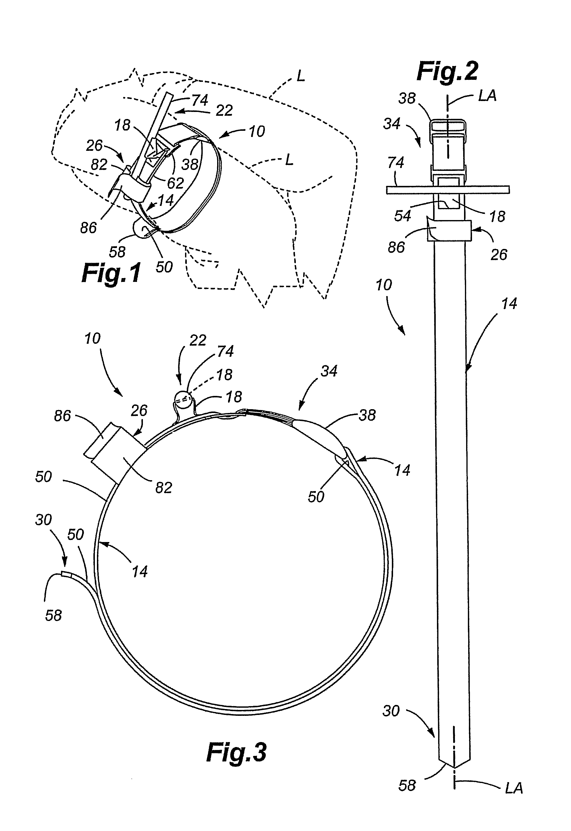 Tourniquet and method of use