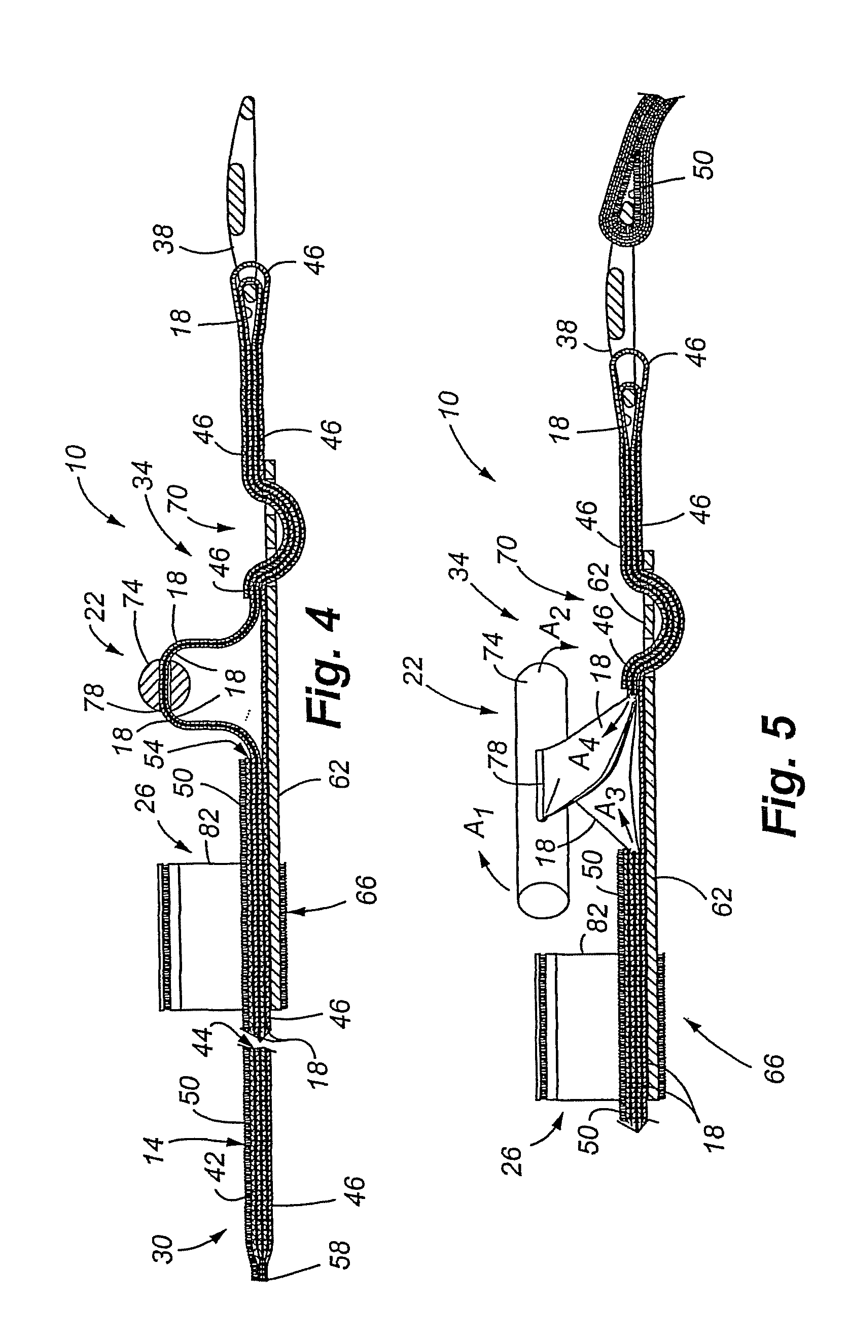 Tourniquet and method of use