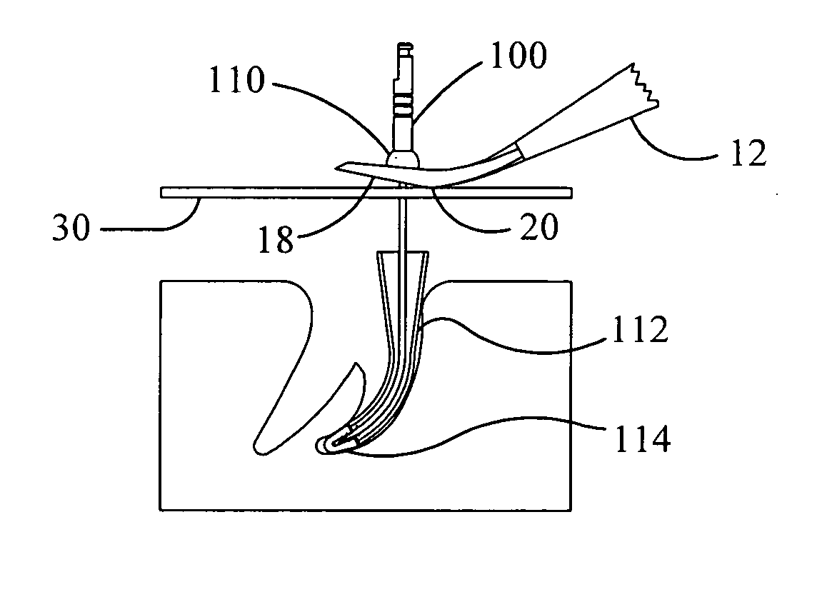 Dental system for root and root tip extraction