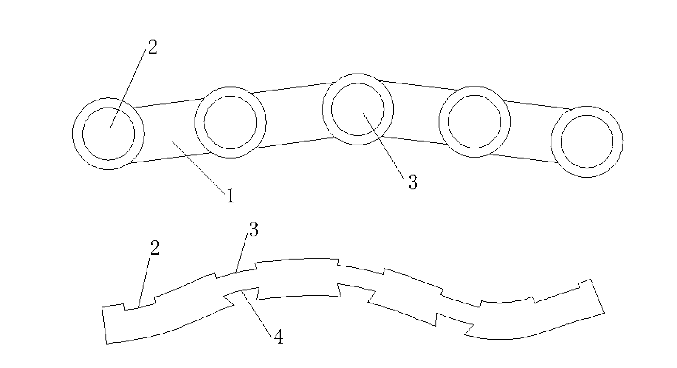 Internal fixator for posterior acetabular wall fractures