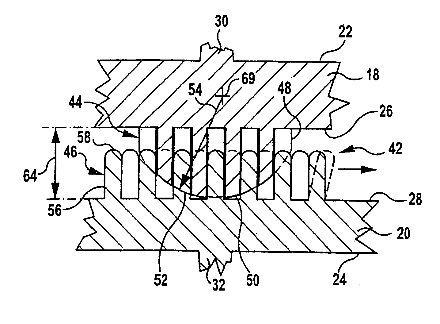 Intervertebral implant