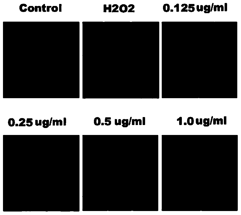 Compound fisetin microemulsion gel as well as preparation method and application thereof