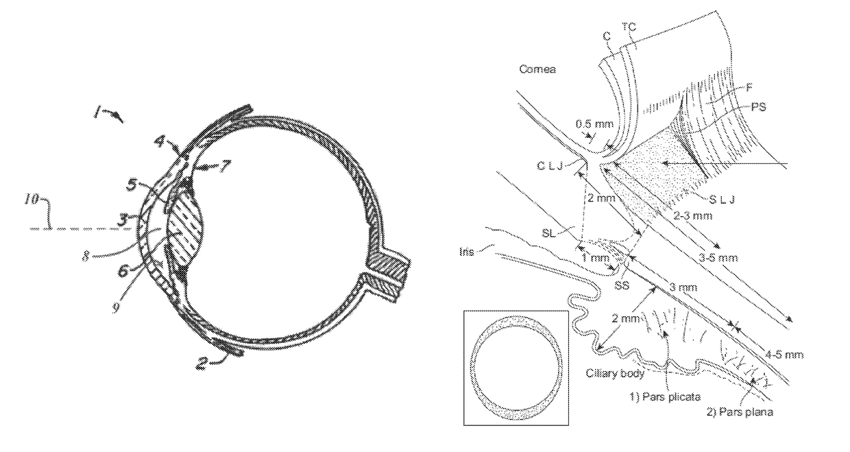 Convex contact probe for the delivery of laser energy