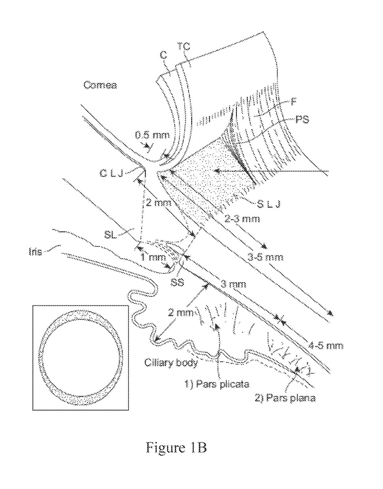 Convex contact probe for the delivery of laser energy