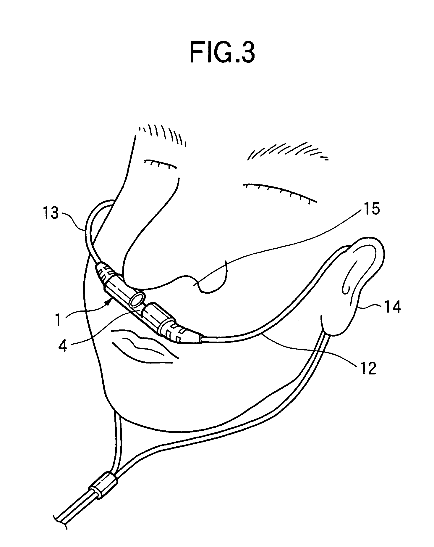 Sensor for measuring carbon dioxide in respiratory gas