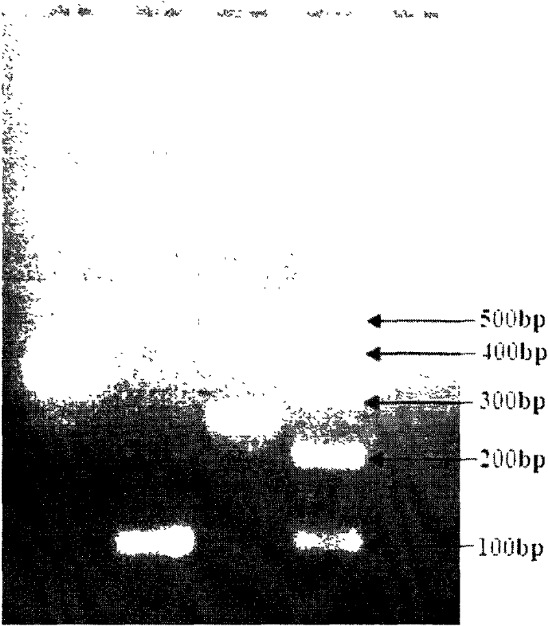 New method for rapid detection of G genotype of group A rotavirus by VP7 gene