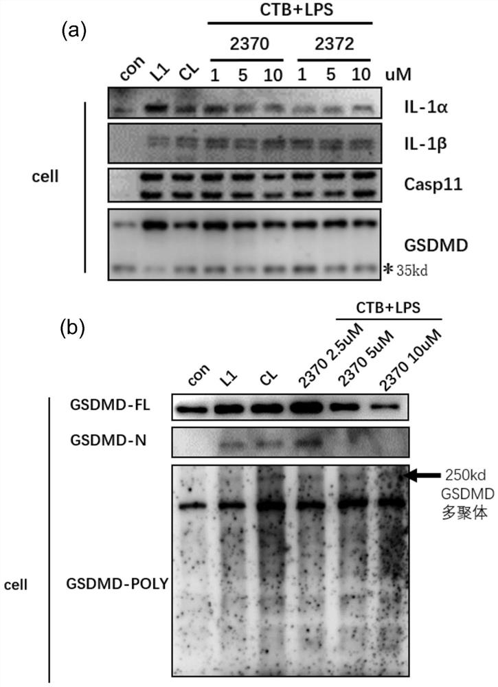 Application of amide compound in preparation of drug for treating sepsis