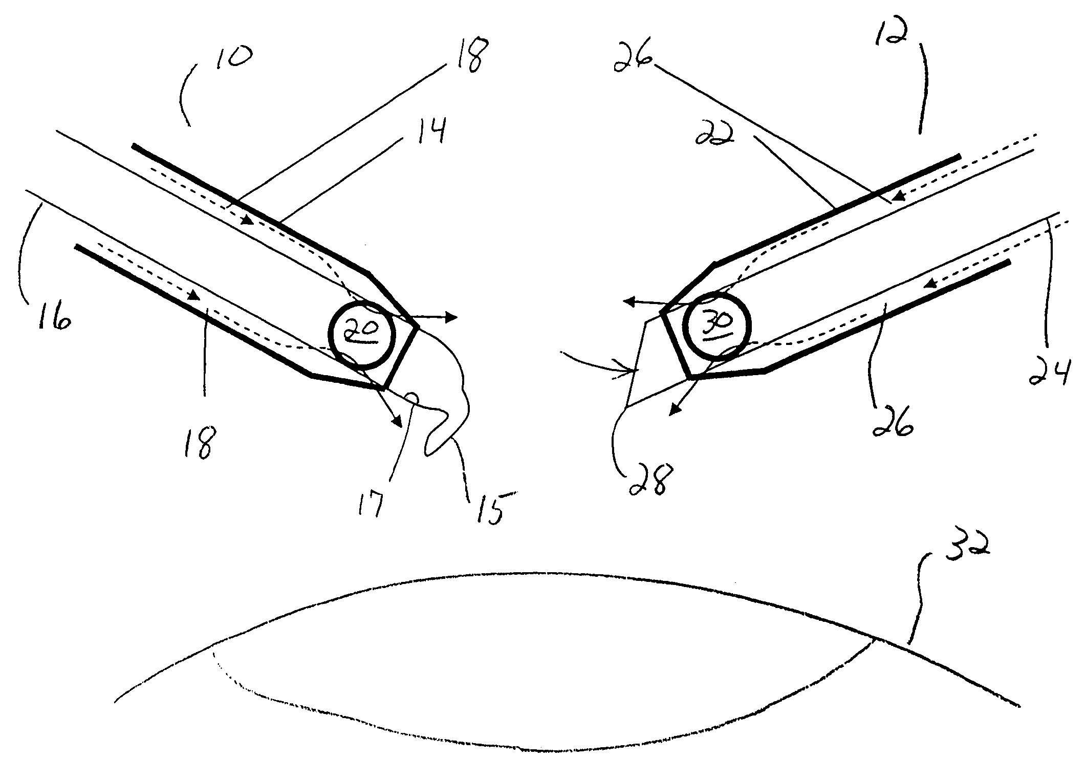 Surgical method and apparatus