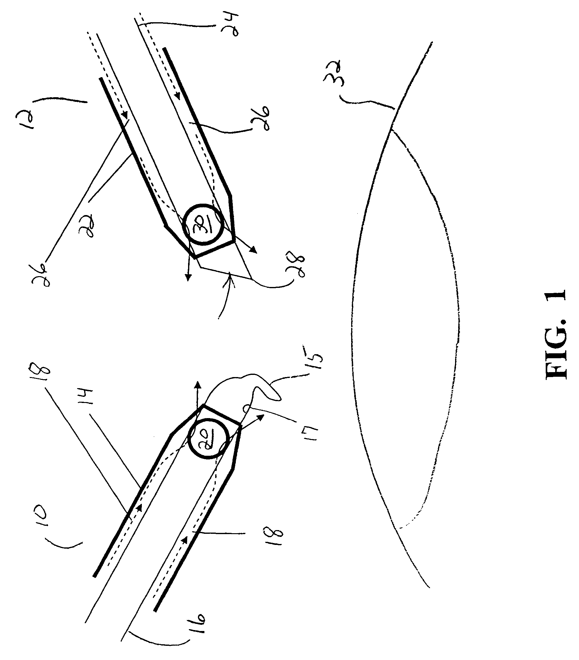 Surgical method and apparatus