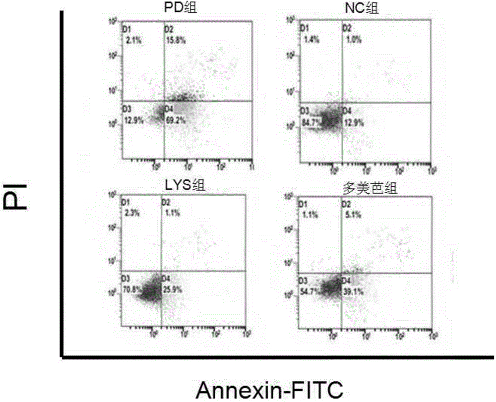 Application of chlorogenic acid in preparation of medicines for treating parkinson disease