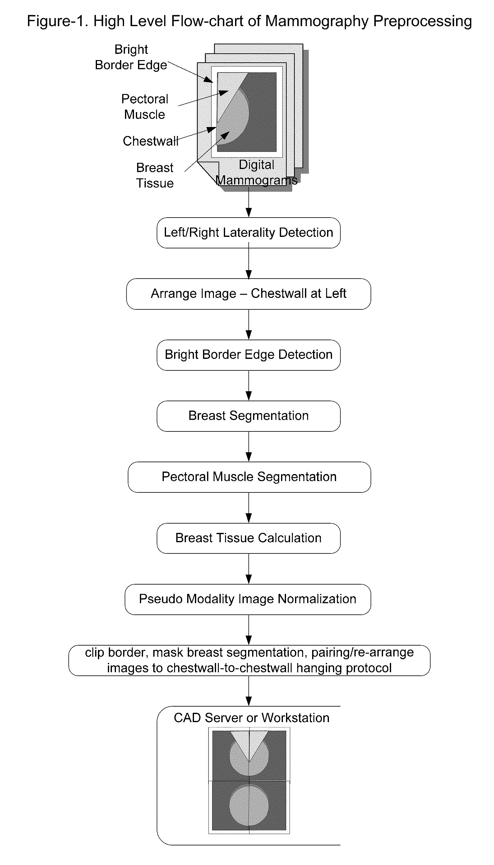 Fast preprocessing algorithms for digital mammography CAD and workstation