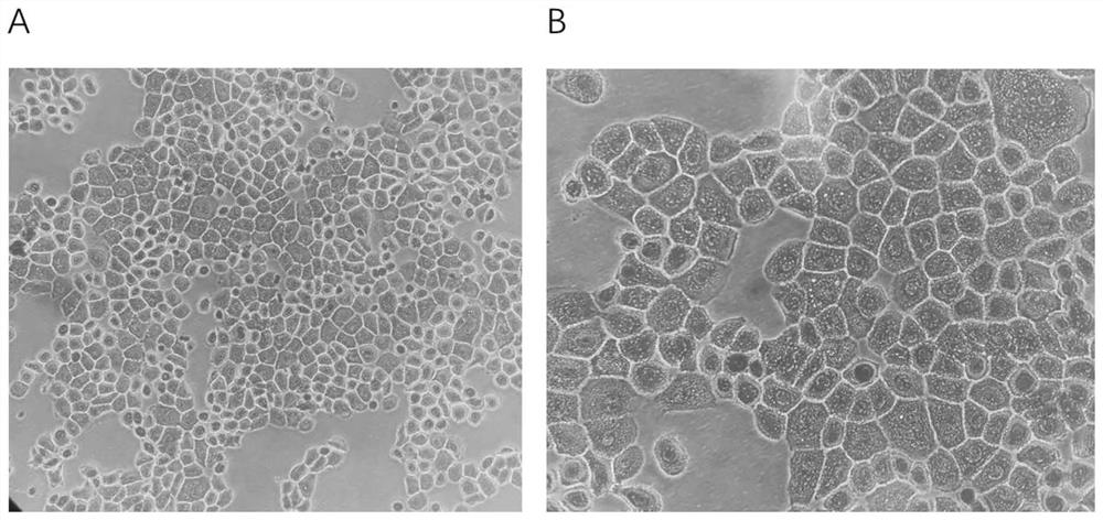 Human esophageal squamous carcinoma cell line NCCE1 as well as establishment method and application thereof