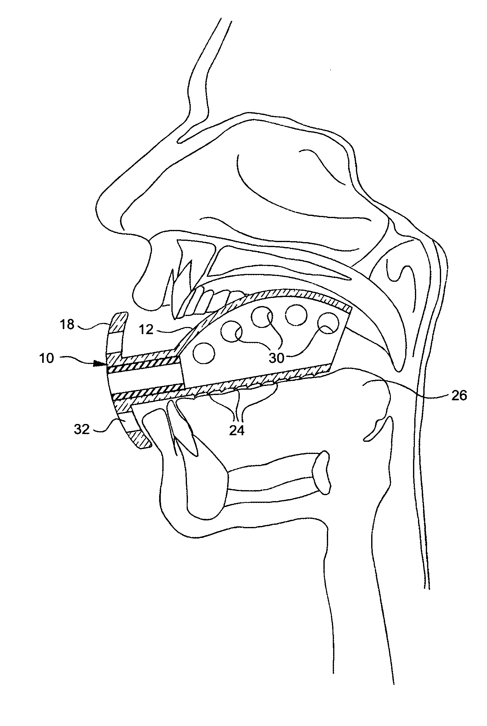 Gag-less airway for snoring prevention