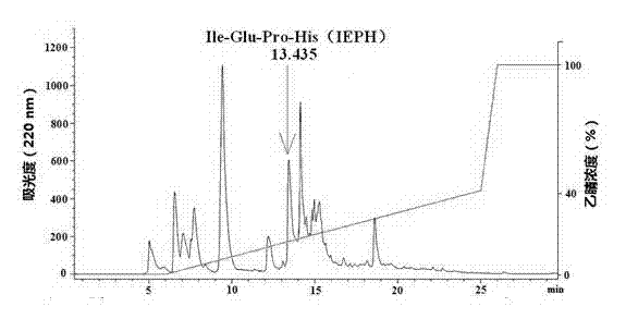 Dasyatis akajei chondroprotein polypeptide capable of resisting prostate cancer, and preparation method and application thereof