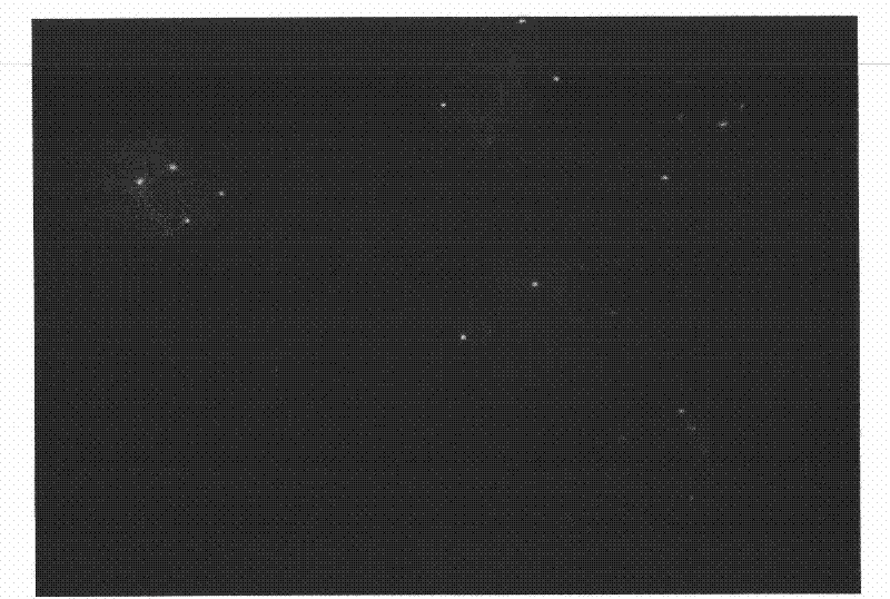 Human chromosome P16 gene detection kit and application thereof