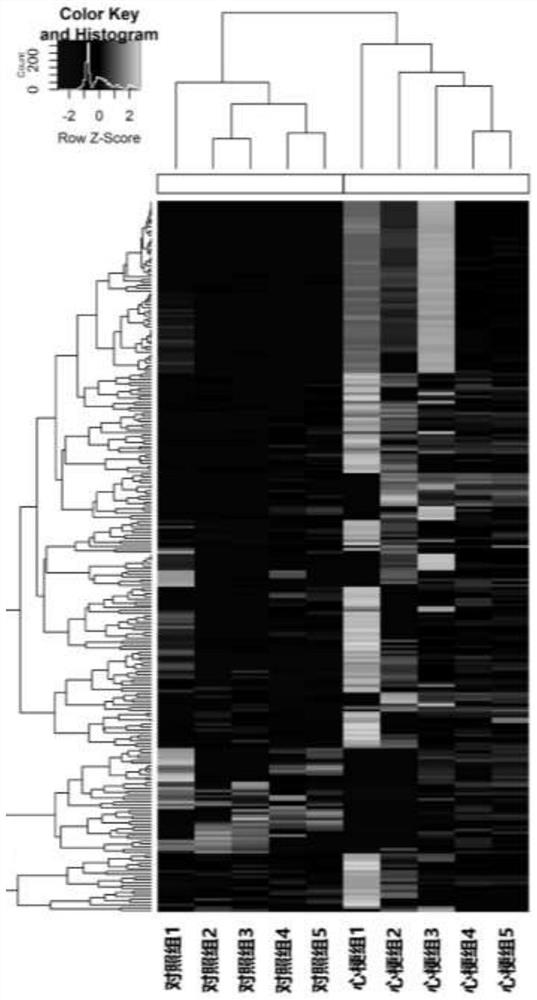 Myocardial infarction related chromosome outer circular DNA as well as screening method and application thereof