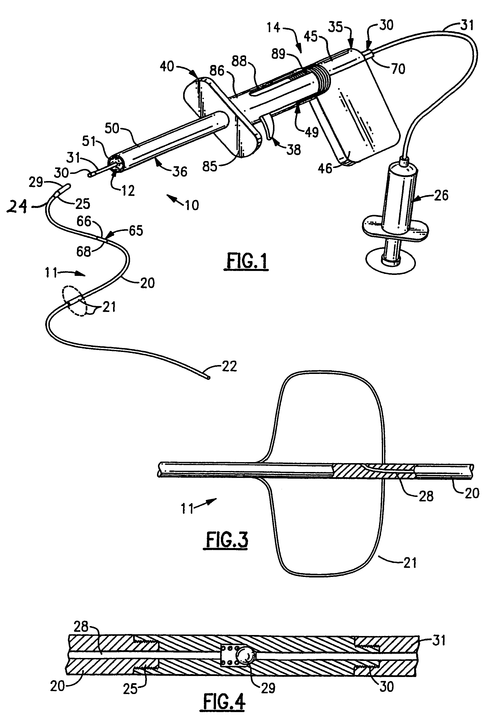 Blood vessel sealing system