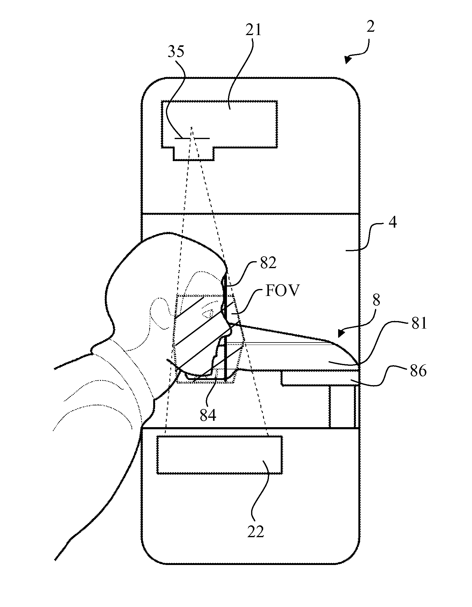 CT apparatus for imaging cranial anatomies