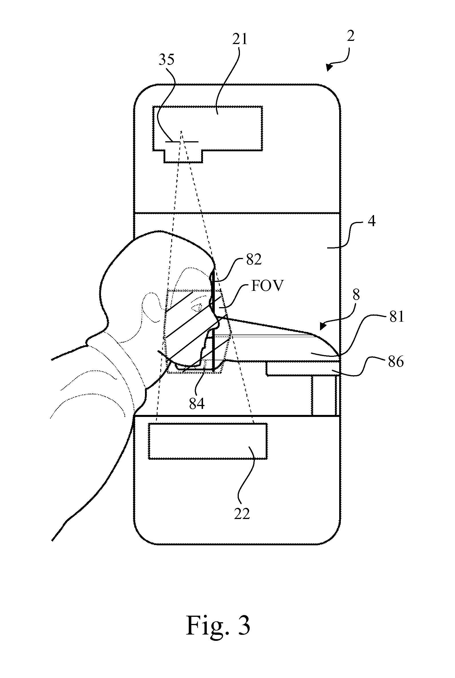 CT apparatus for imaging cranial anatomies