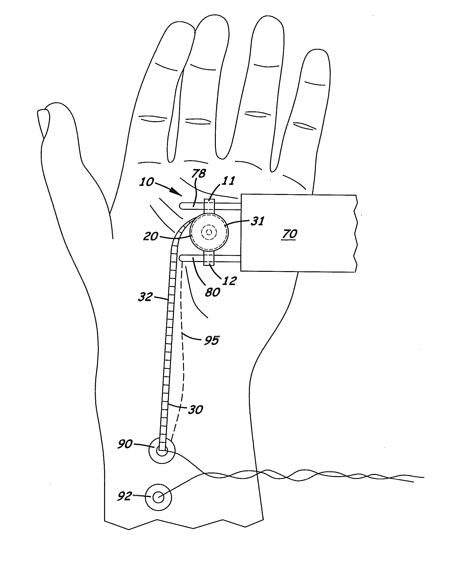 Nerve Path Adaptable Nerve Testing Device