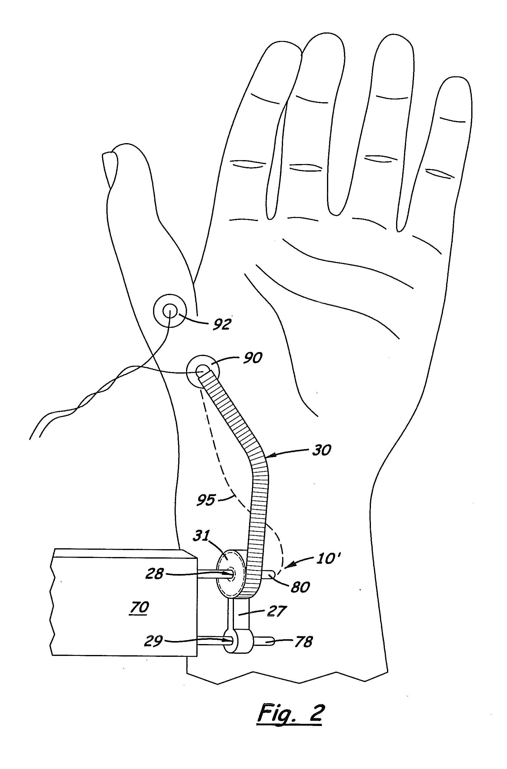 Nerve Path Adaptable Nerve Testing Device