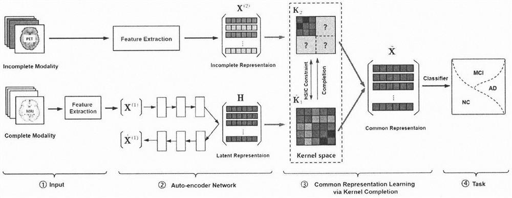 Missing multi-modal representation learning algorithm for Alzheimer's disease diagnosis