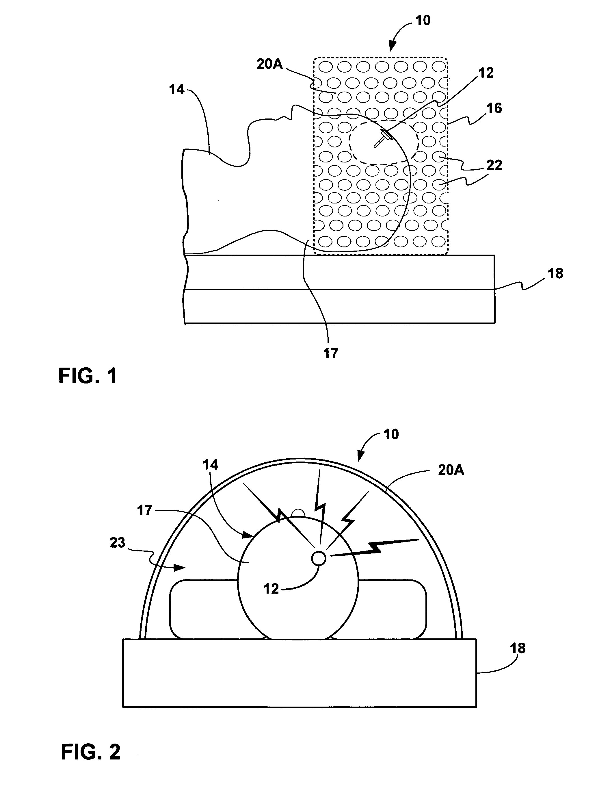 Intracranial pressure monitoring system