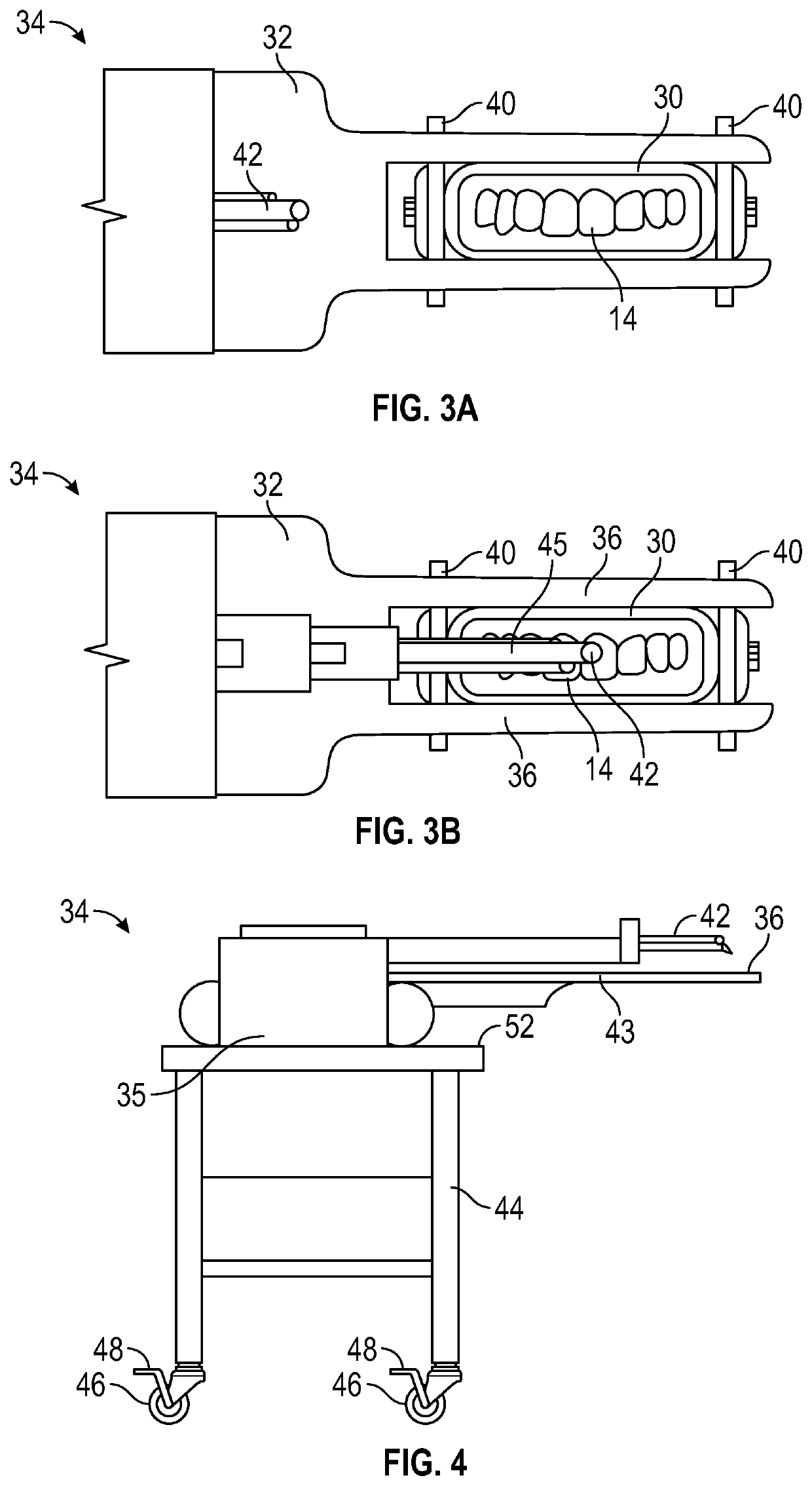 Apparatus for in situ restoration of unconstrained dental structure