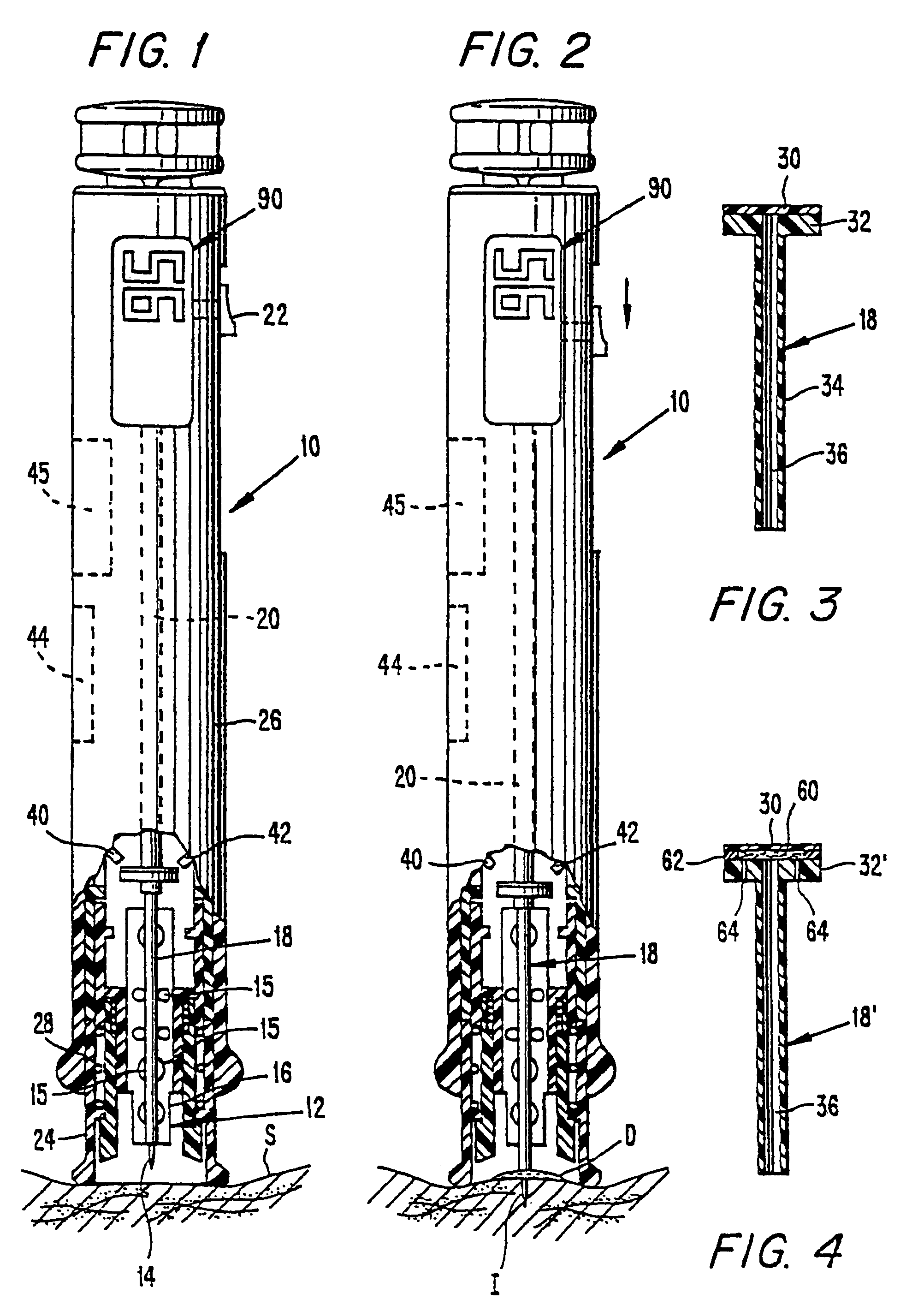 Methods and apparatus for sampling and analyzing body fluid