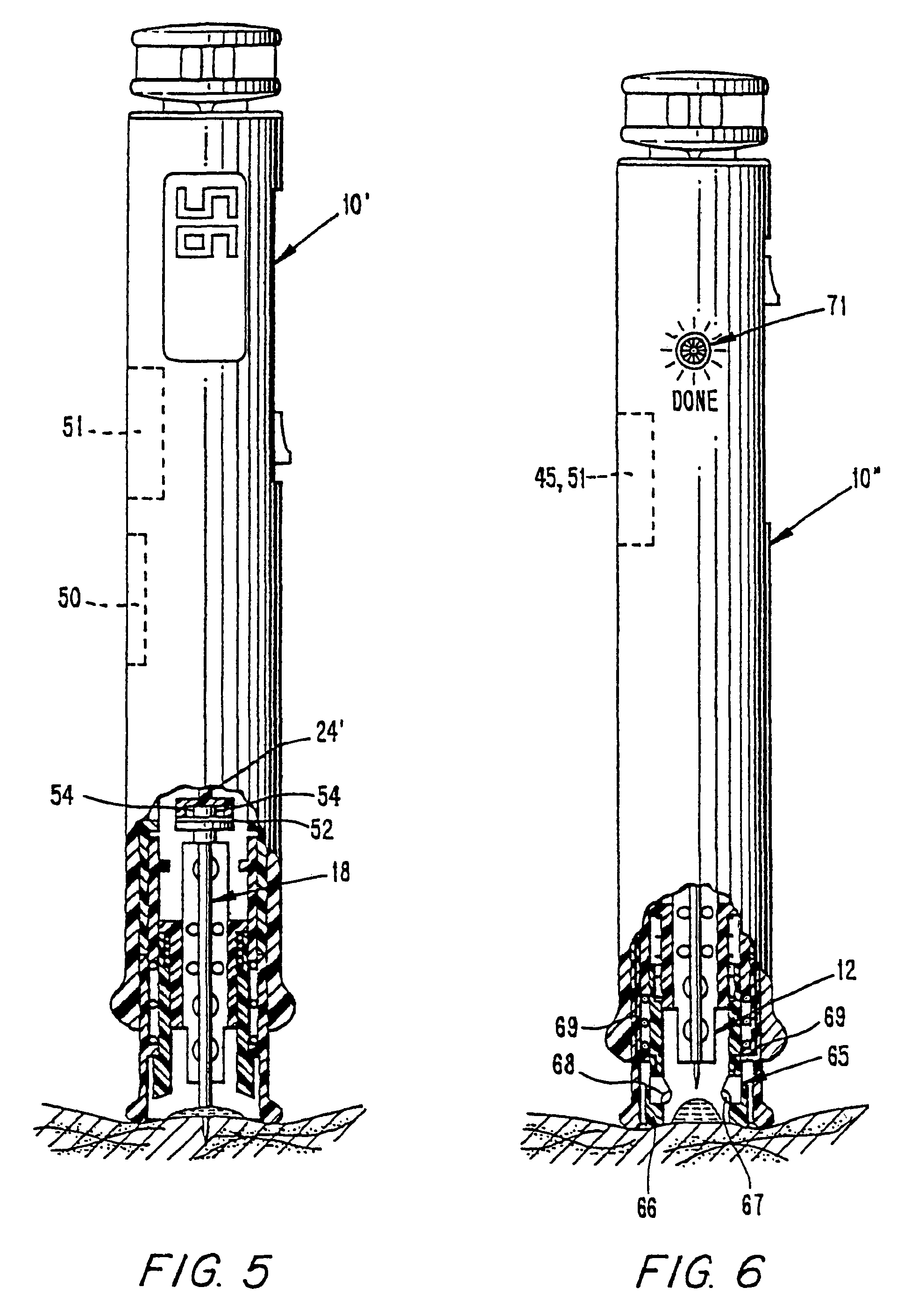 Methods and apparatus for sampling and analyzing body fluid