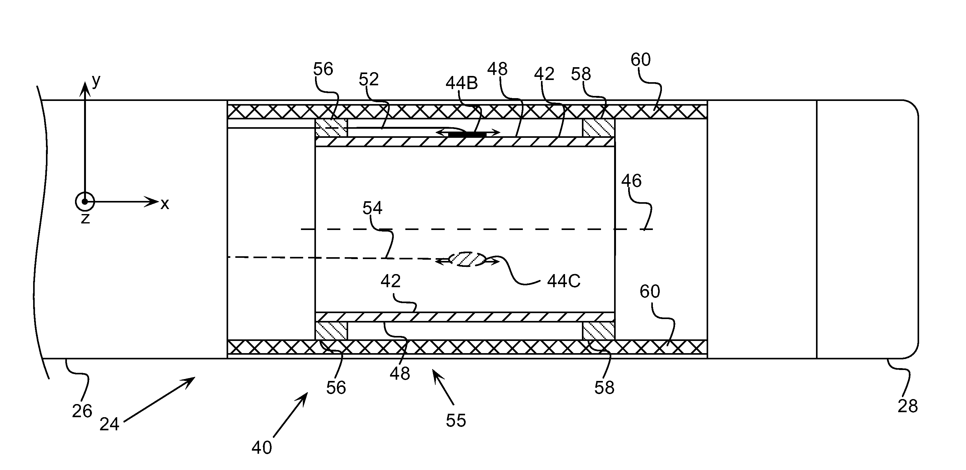 Catheter with strain gauge sensor