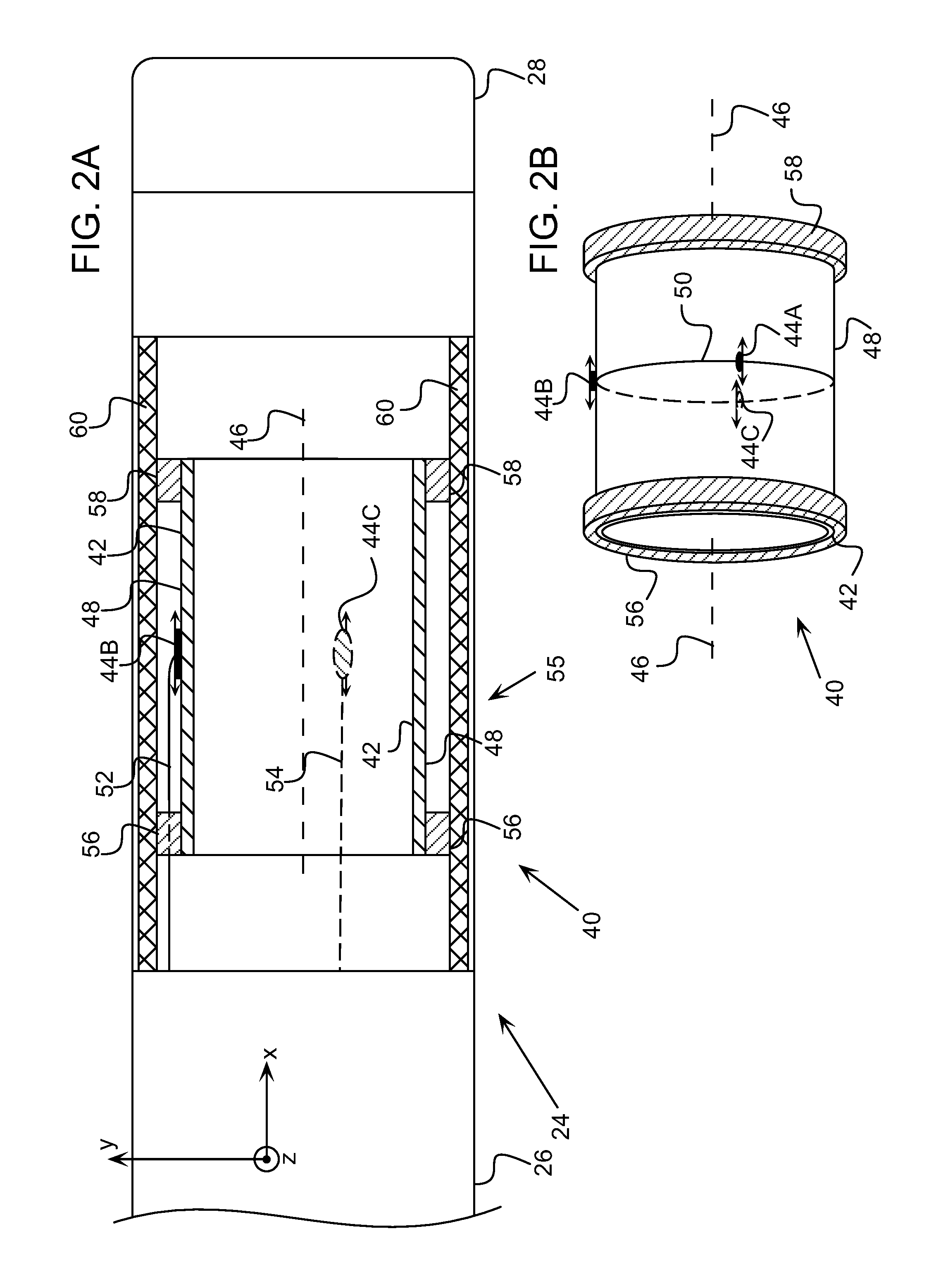 Catheter with strain gauge sensor