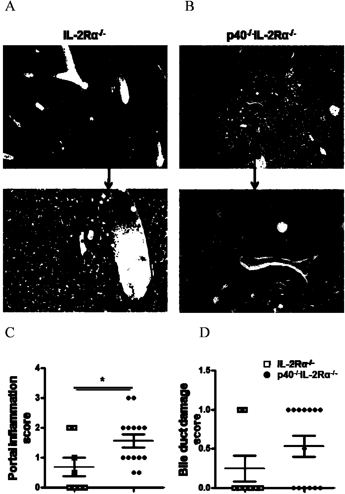 Method for breeding IL-12p40 (-/-) IL-2R alpha (-/-) mice used as hepatic fibrosis and primary biliary cirrhosis animal models