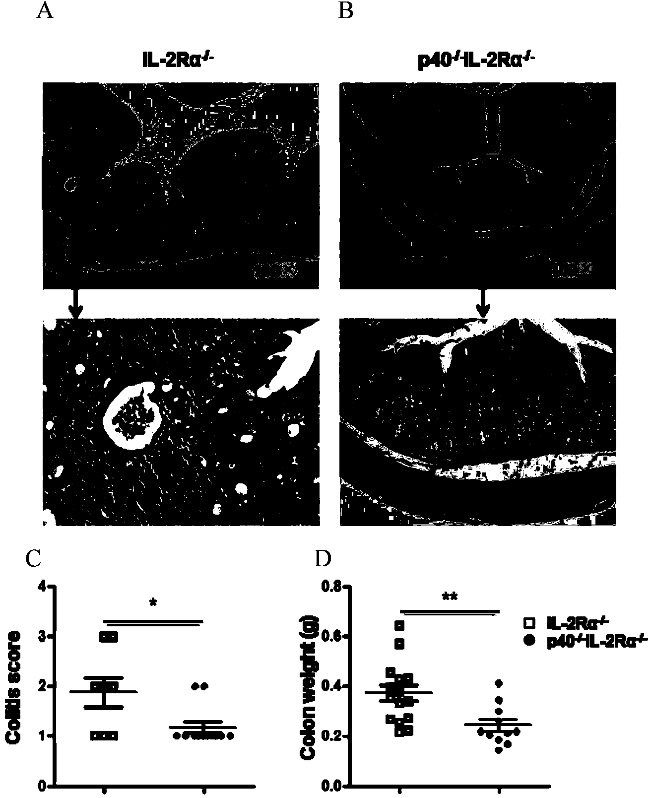 Method for breeding IL-12p40 (-/-) IL-2R alpha (-/-) mice used as hepatic fibrosis and primary biliary cirrhosis animal models