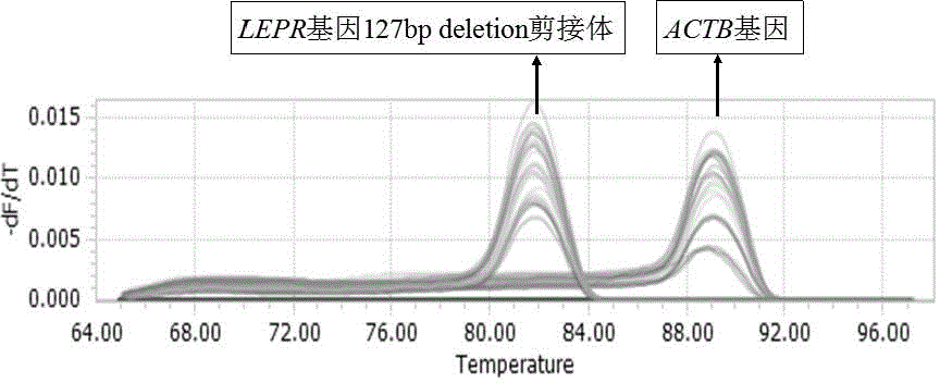 Primer and kit for detecting 127bp deletion variable spliceosome of LEPR gene and detecting method