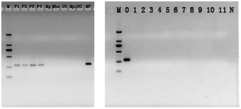 PCR (Polymerase Chain Reaction) primers for detecting mycoplasma pneumoniae (MP) and application thereof