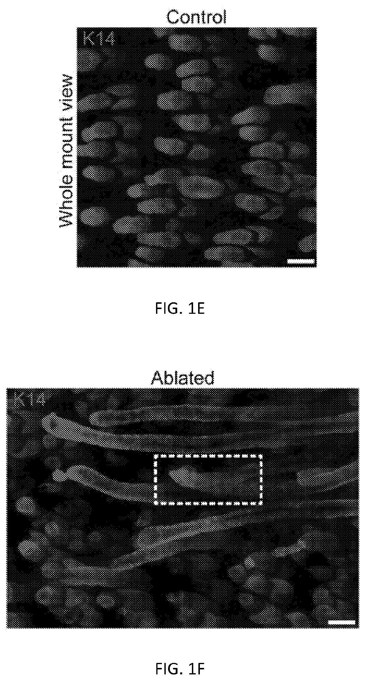 Method for preventing hair loss