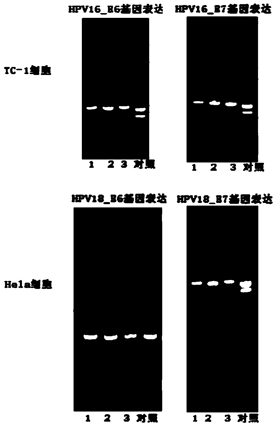 PAP (pokeweed antiviral protein) freeze-dried powder compounding agent and preparation method of thereof