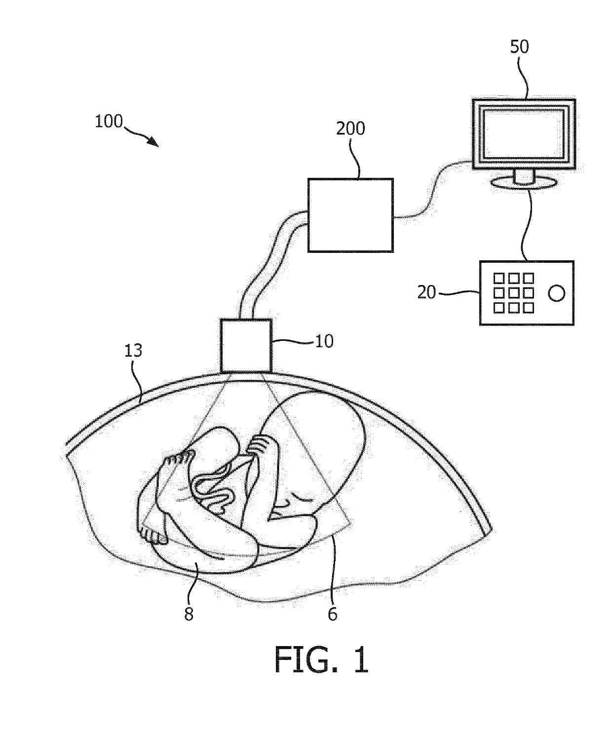 3D image compounding for ultrasound fetal imaging