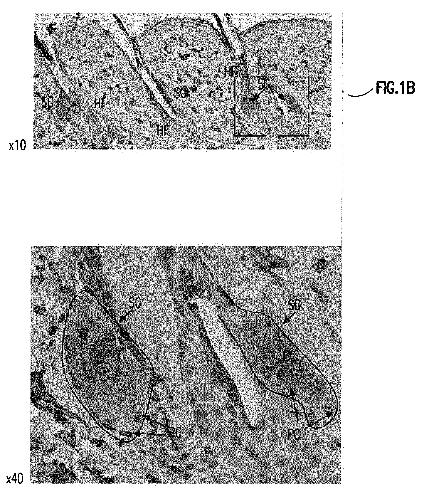 Visfatin therapeutic agents for the treatment of acne and other conditions