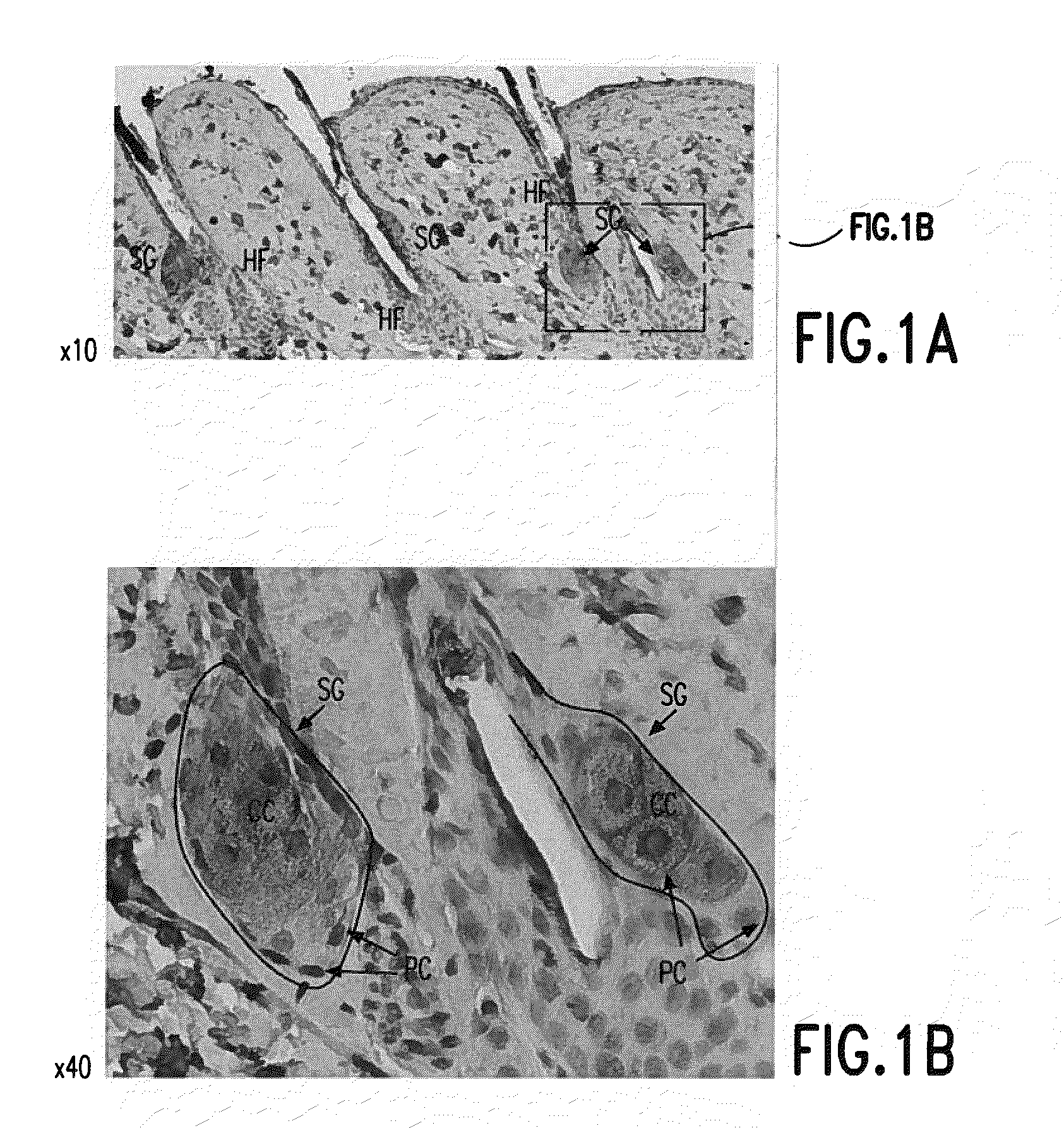 Visfatin therapeutic agents for the treatment of acne and other conditions