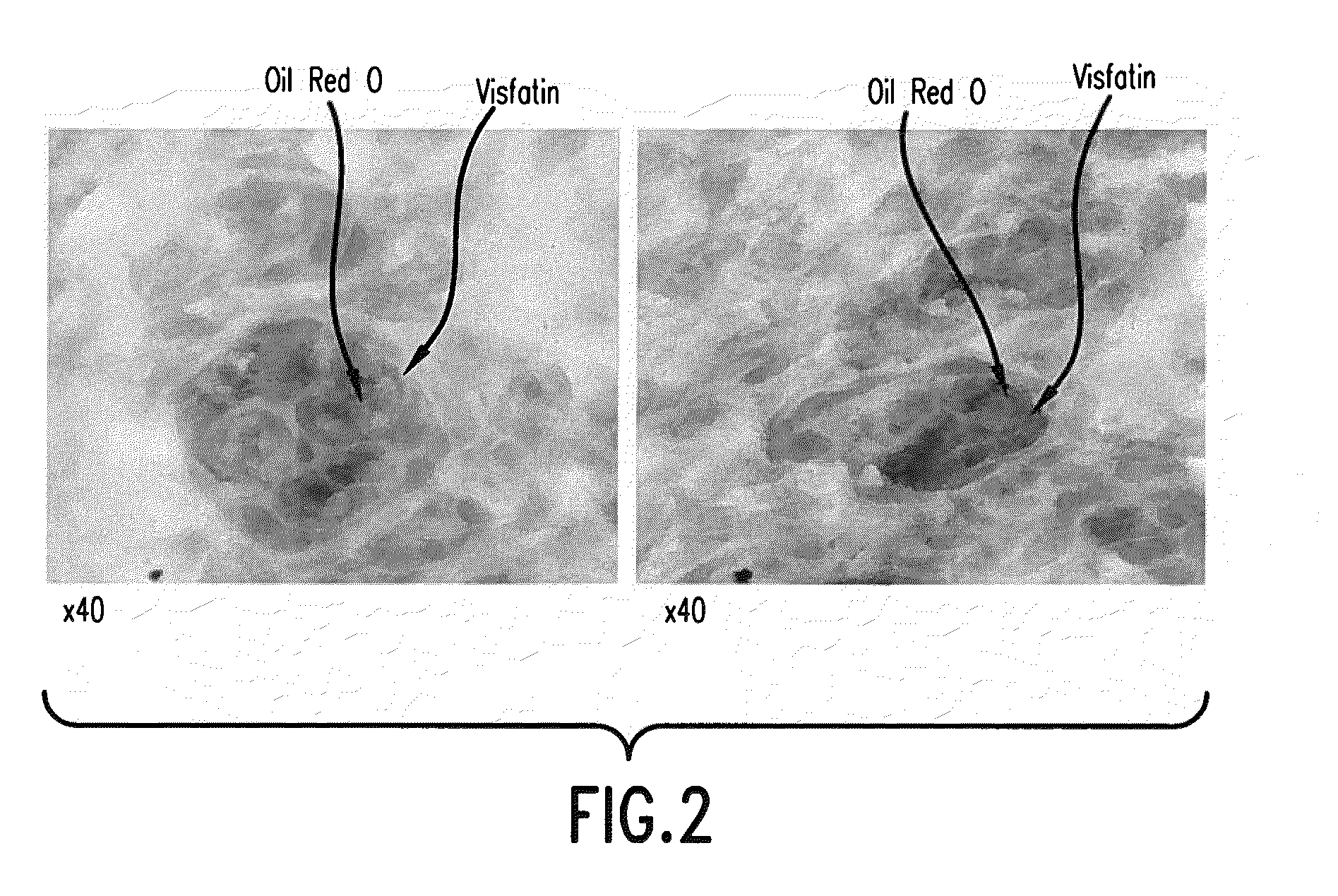 Visfatin therapeutic agents for the treatment of acne and other conditions