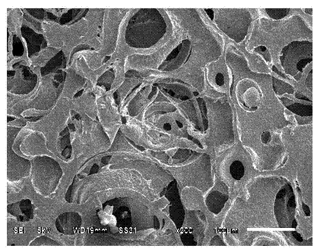 Starch-derived absorbable medical sponge and preparation method thereof