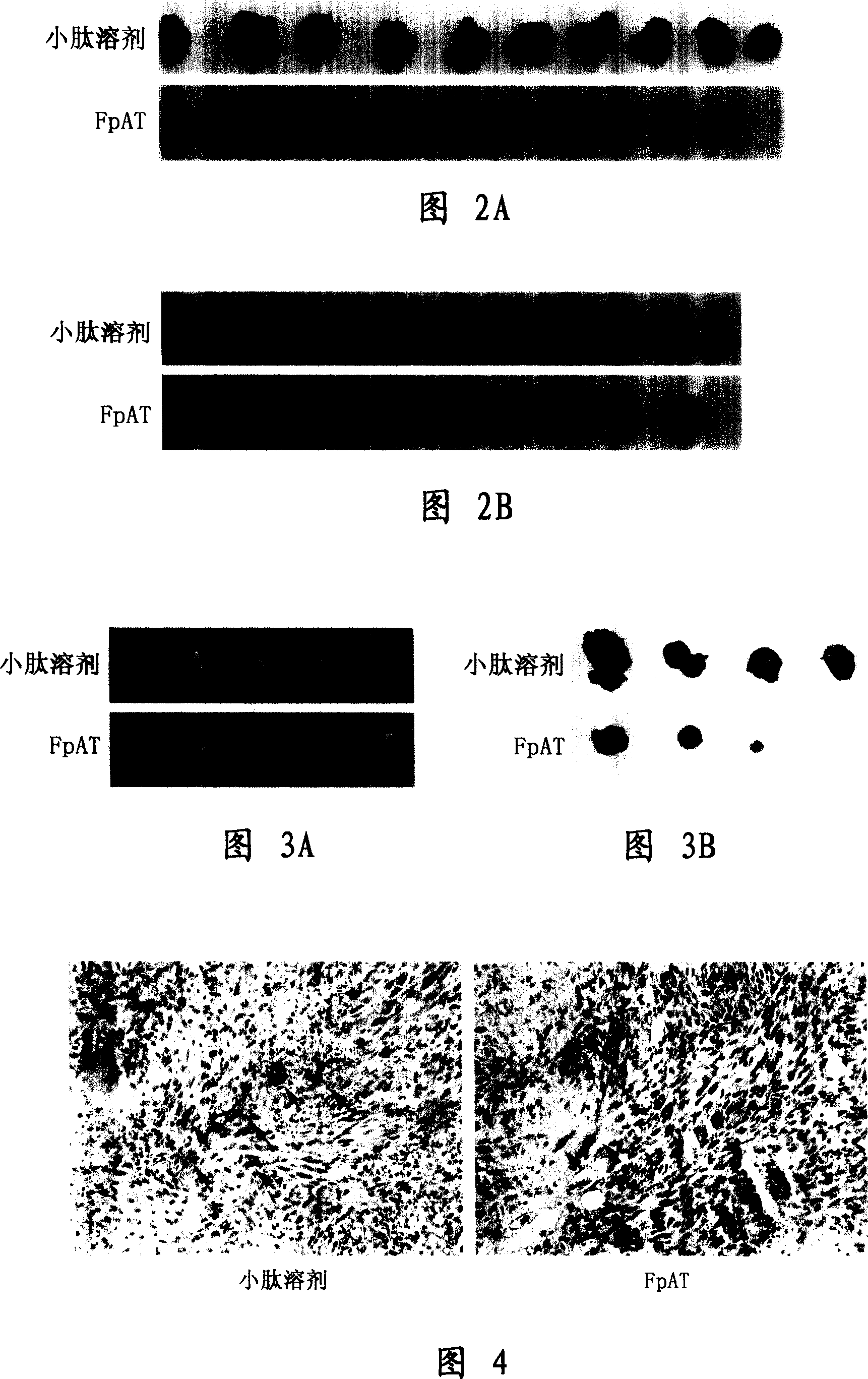 Peptide for treatment of vascellum generation and uses thereof